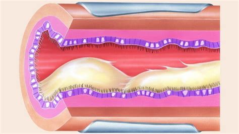 Shortness of Breath: Symptoms, Causes, and When to See Your Doctor | 1MD Nutrition™