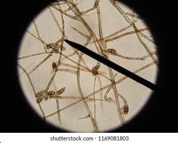 Macroconidia Characteristic Curvularia Spp Under Microscope Foto de stock 1169081803 | Shutterstock