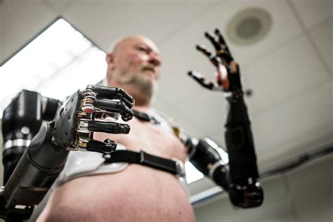 Robotic Human Arm Implantations