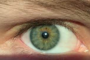 File:Human-eye-color-green.png - Wikimedia Commons