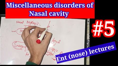 miscellaneous disorders of nasal cavity🔴ENT (NOSE) LECTURES SERIES #5. #NASAL_CAVITY - YouTube