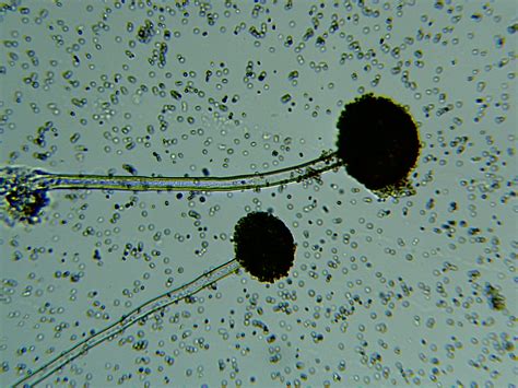 Rhizopus bread mold under microscope | World under Microscope