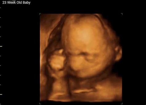 3D 4D Ultrasound at 23 Weeks Video - View A Miracle 3D/4D/5D Ultrasounds