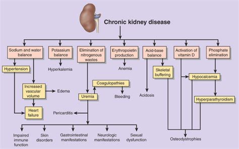 Opinions on Chronic kidney disease