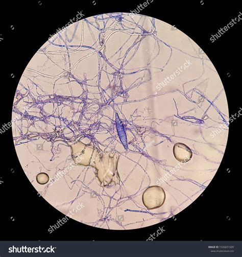 Ringworm Under Microscope