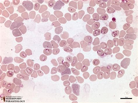 Babesia sp. Protozoa - MONSTER HUNTER'S GUIDE TO: VETERINARY PARASITOLOGY