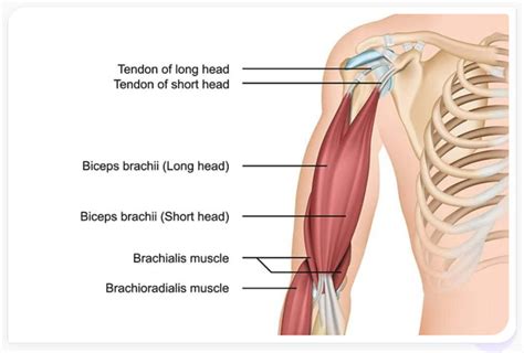 Distal Biceps Tendon Tears| Advanced Regenerative Medicine