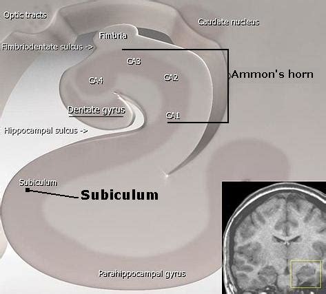 subiculum - meddic