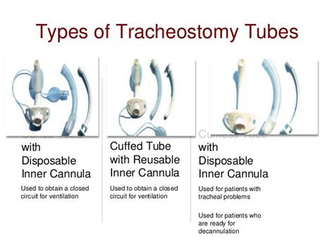 Tracheostomy Types