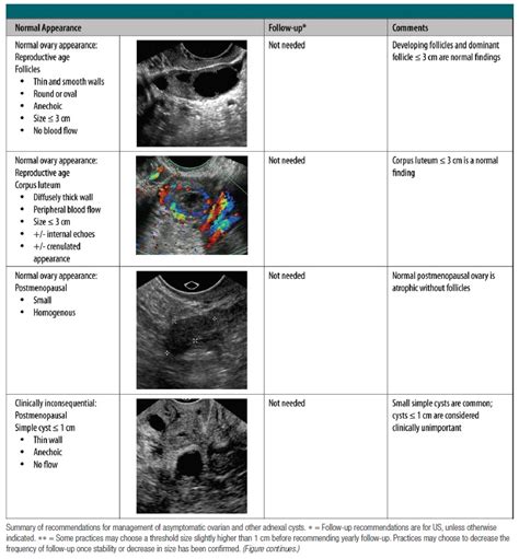 Ovarian Cyst F/U Guideline – Radiology.World