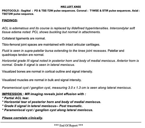 Knee MRI Cost, Purpose, Procedure, Risks & Results [2024]