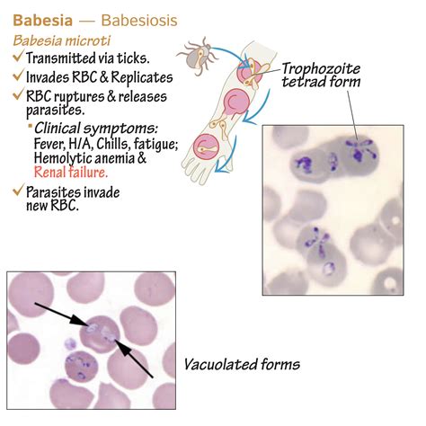 Immunology/Microbiology Glossary: Protozoa - Babesia & Babesiosis | Draw It to Know It