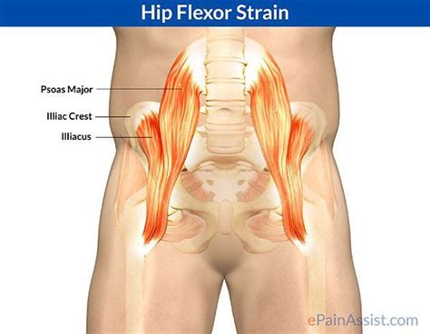 Hip Flexor Stretch: Hip flexor strain is also called as psoas strain, ... | Hip flexor, Recovery ...