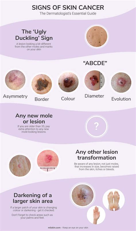 Skin Cancer Signs & Symptoms | The Dermatologist's Essential Guide