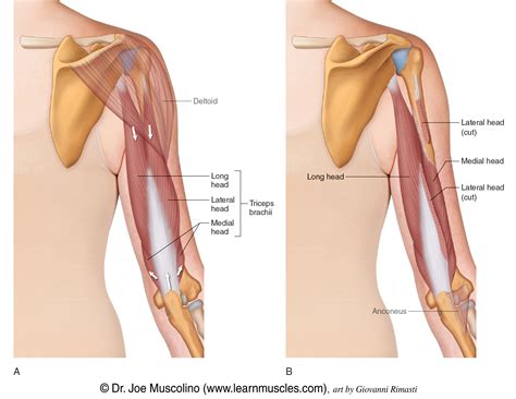 Triceps Muscle Strain: Cause, Symptoms, Treatment, Exercise Samarpan | atelier-yuwa.ciao.jp