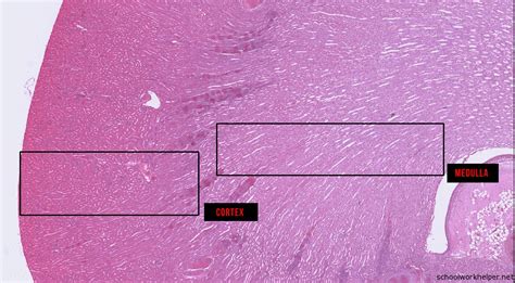 kidney-1-slide-labelled-histology - Schoolworkhelper | Upload & Educate