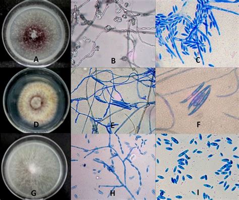 Microconidia Of Fusarium