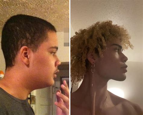 Mewing Before & After: 122+ Progress Photos (Male & Female Transformations)