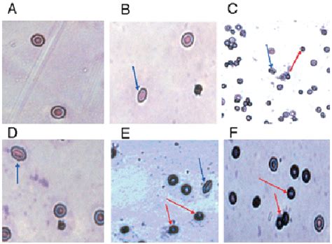 Red blood cells (400x magnification) exposed for 1h to increasing... | Download Scientific Diagram