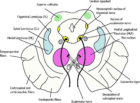 Inferior Colliculus Cross Section