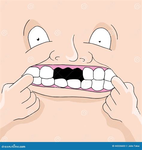 Missing Teeth stock vector. Image of symbol, illustration - 44326603