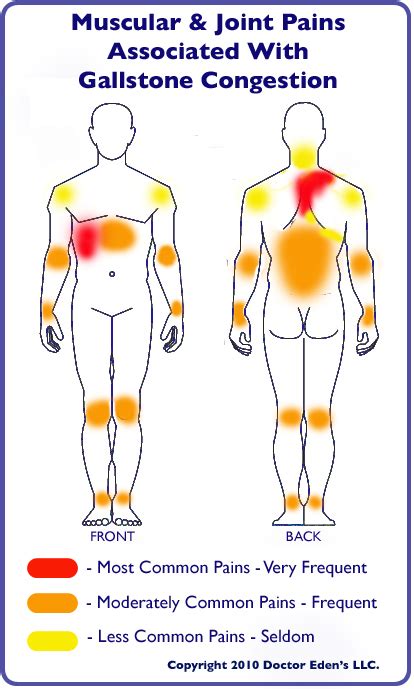 gallstone-pain - Gallbladder Attack & Gallbladder Pain Treatment