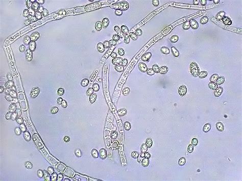 Fungi Mold Under Microscope Mic-uk a backyard mini-project- airborne fungi5