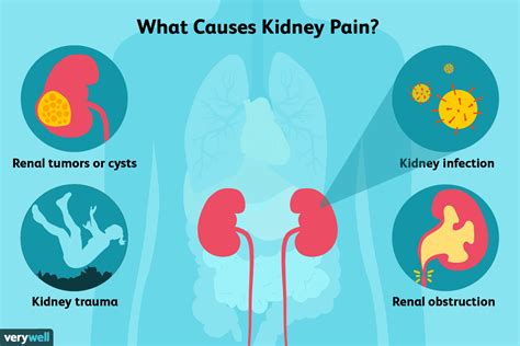 Kidney Symptoms Back Pain