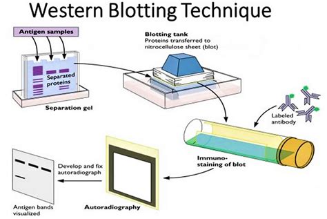 Western blot test, procedure & purpose of western blot