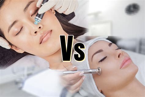 Which treatment is best? Hydrafacial or Microdermabrasion - Avia Medical Spa