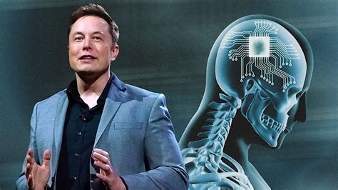 Elon Musk’s Neuralink To Begin Implanting Advanced Chips In Human Brains, Seeks Government ...