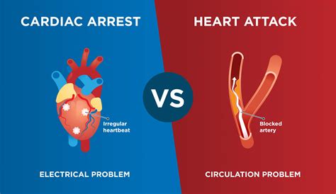 Differences between heart attack and cardiac arrest - Rapid Response Revival