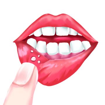 Oral Diseases PNG Transparent Images Free Download | Vector Files | Pngtree