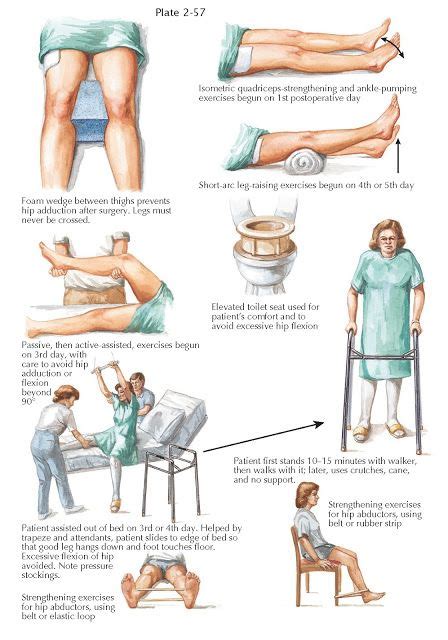 REHABILITATION AFTER TOTAL HIP REPLACEMENT in 2021 | Hip extension exercise, Total hip ...