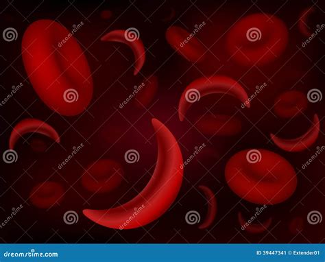 Sickle-cell and Normal Red Blood Cells Stock Illustration - Illustration of medical, anaemia ...