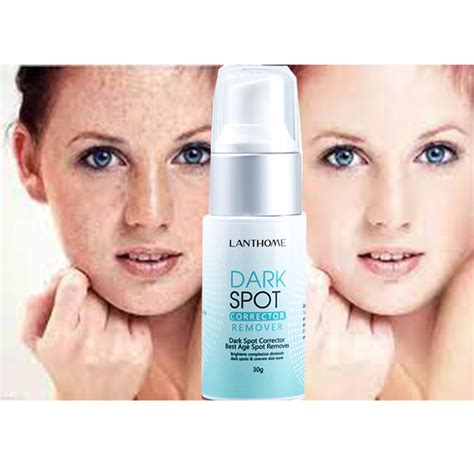 Age Spot Remover | vlr.eng.br