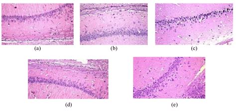 Histopathological findings of subiculum in the hippocampus: (a) There... | Download Scientific ...