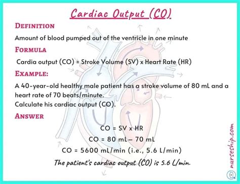 Cardiac Preload vs Afterload vs Contractility |With an example - Nurseship.com