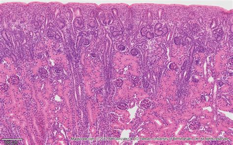 Kidney Renal Cortex Histology