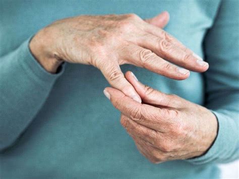 Osteoarthritis: 10 Osteoarthritis Symptoms