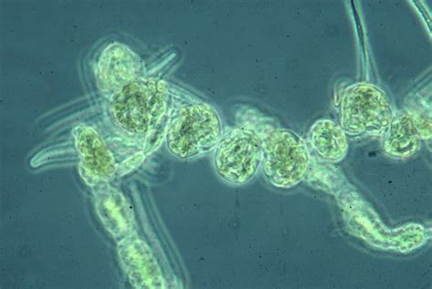 Species Of Cyanobacteria With Microscope Photos