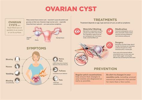 Ovarian Cyst Symptoms And Signs