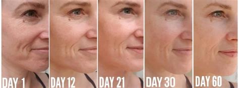 Collagen Before and After Pictures - Do you see the Difference?