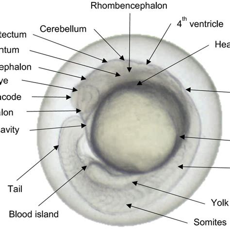 Morphology of normal zebrafish (Danio rerio) embryo at 120 hpf | Download Scientific Diagram