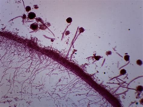 Fungi Molds, 3 Types - Wholemount - Prepared Microscope Slide | Types of fungi, Biology ...