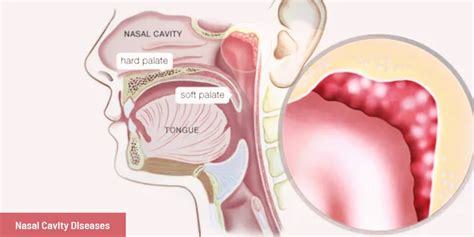 What is Nasal Cavity? Amazing Fun Facts about Nasal Cavity, Diseases, Function & Anatomy