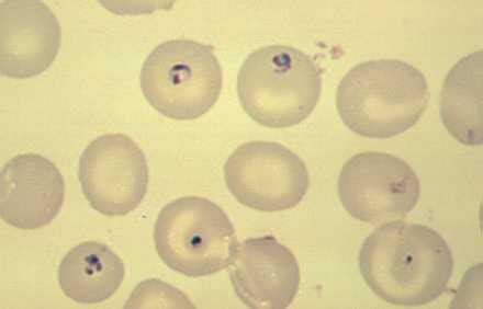 Babesia sp.