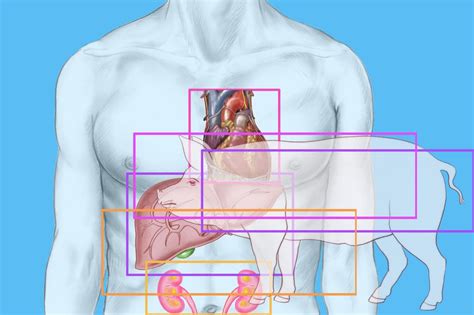 Man Dies Months After Having First Pig Heart Transplant | Latest Science News and Articles ...