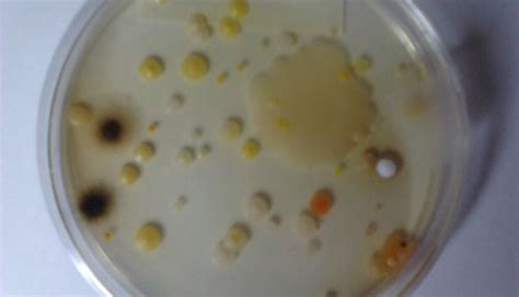 Petri Dish Experiment!