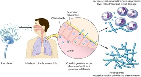 Aspergillus fumigatus- An Overview